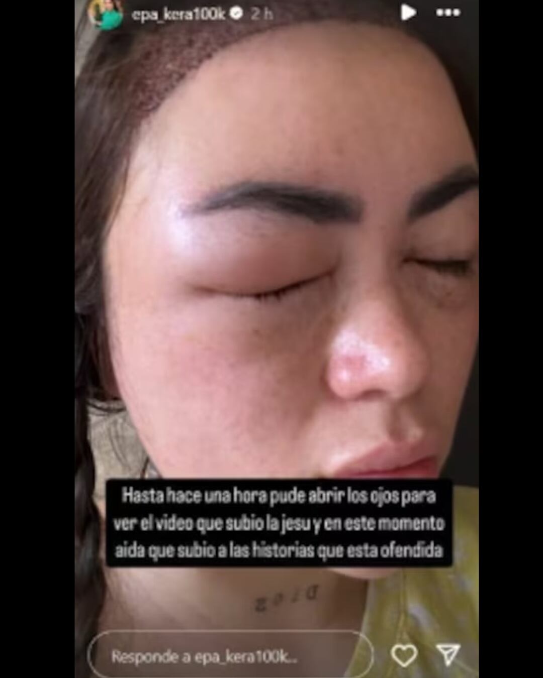 Créditos: Historias de Instagram de Epa Colombia