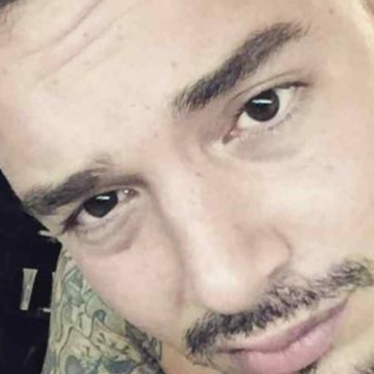 J Balvin se rompió un diente y las redes enloquecieron