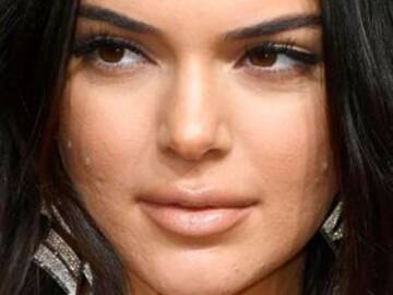 Kendall Jenner responde a críticas sobre su acné