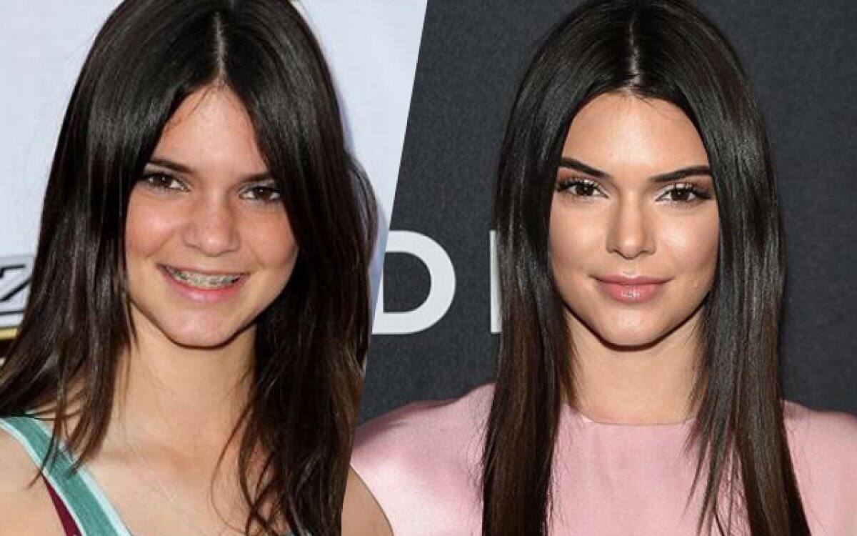 Kendall Jenner