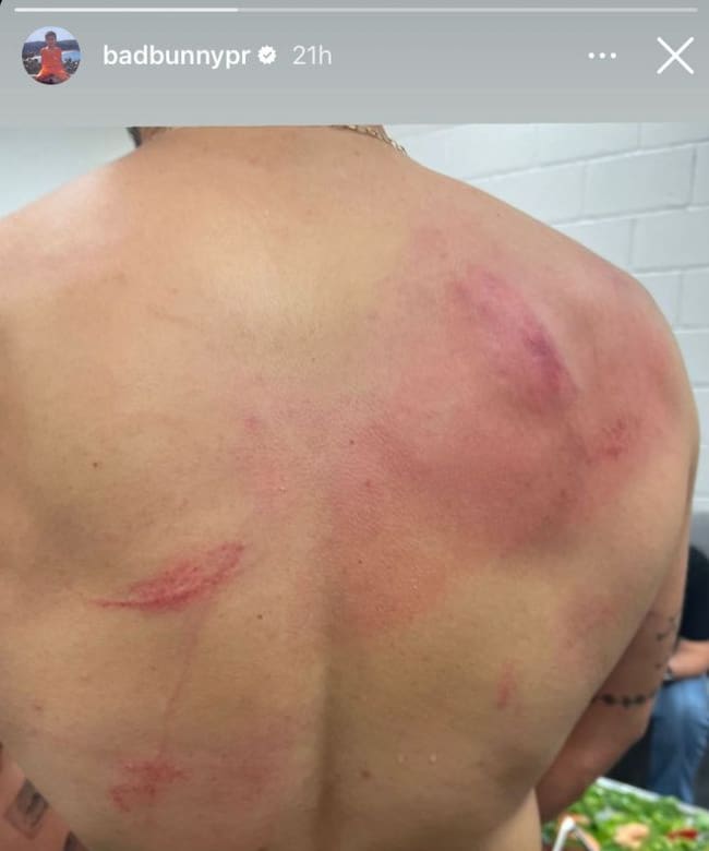 Bad Bunny muestra su espalda en Instagram