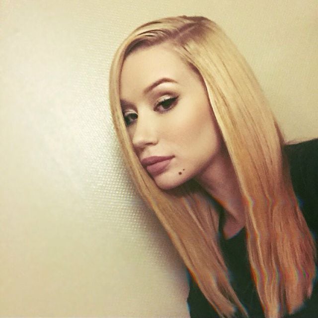 Iggy Azalea sigue retocándose el rostro.