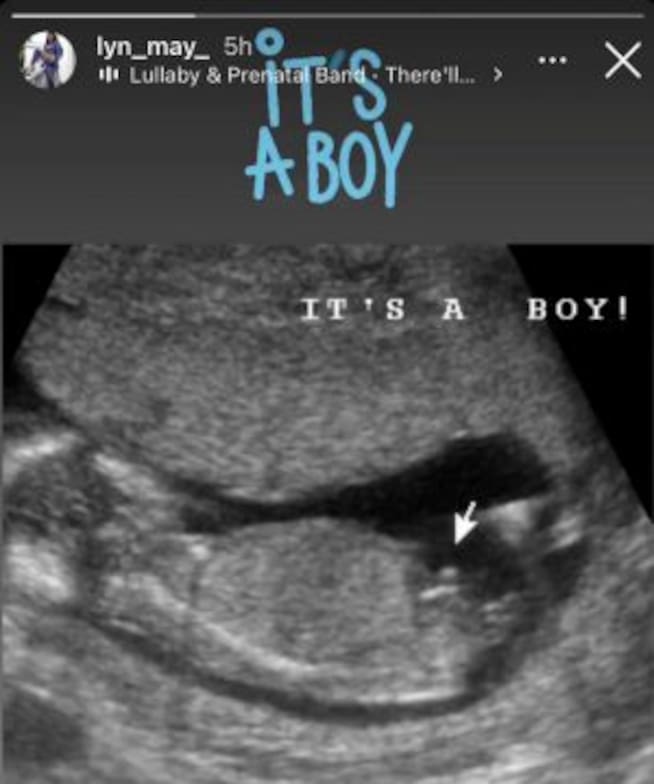 Lyn May confirma embarazo con ultrasonido y confirma esperar un niño