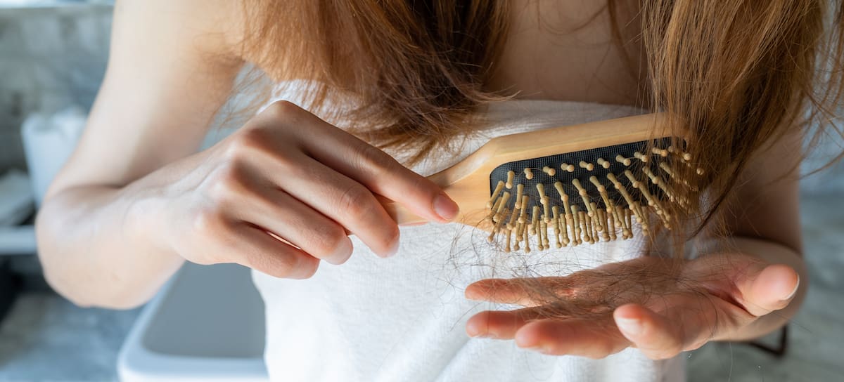 Caída del cabello después del verano