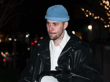 Alarmantes imágenes de Justin Bieber preocupan acerca de su estado de salud