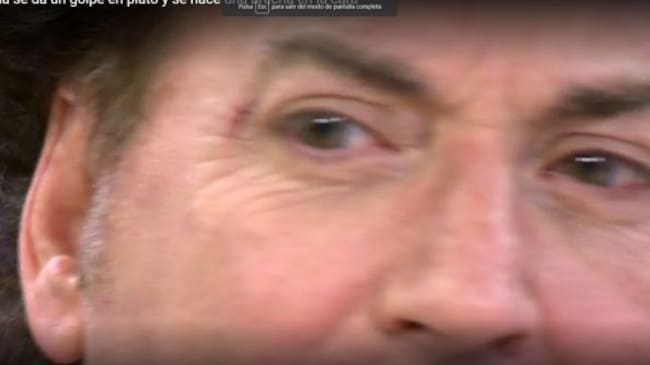 La ceja de Pipi Estrada.