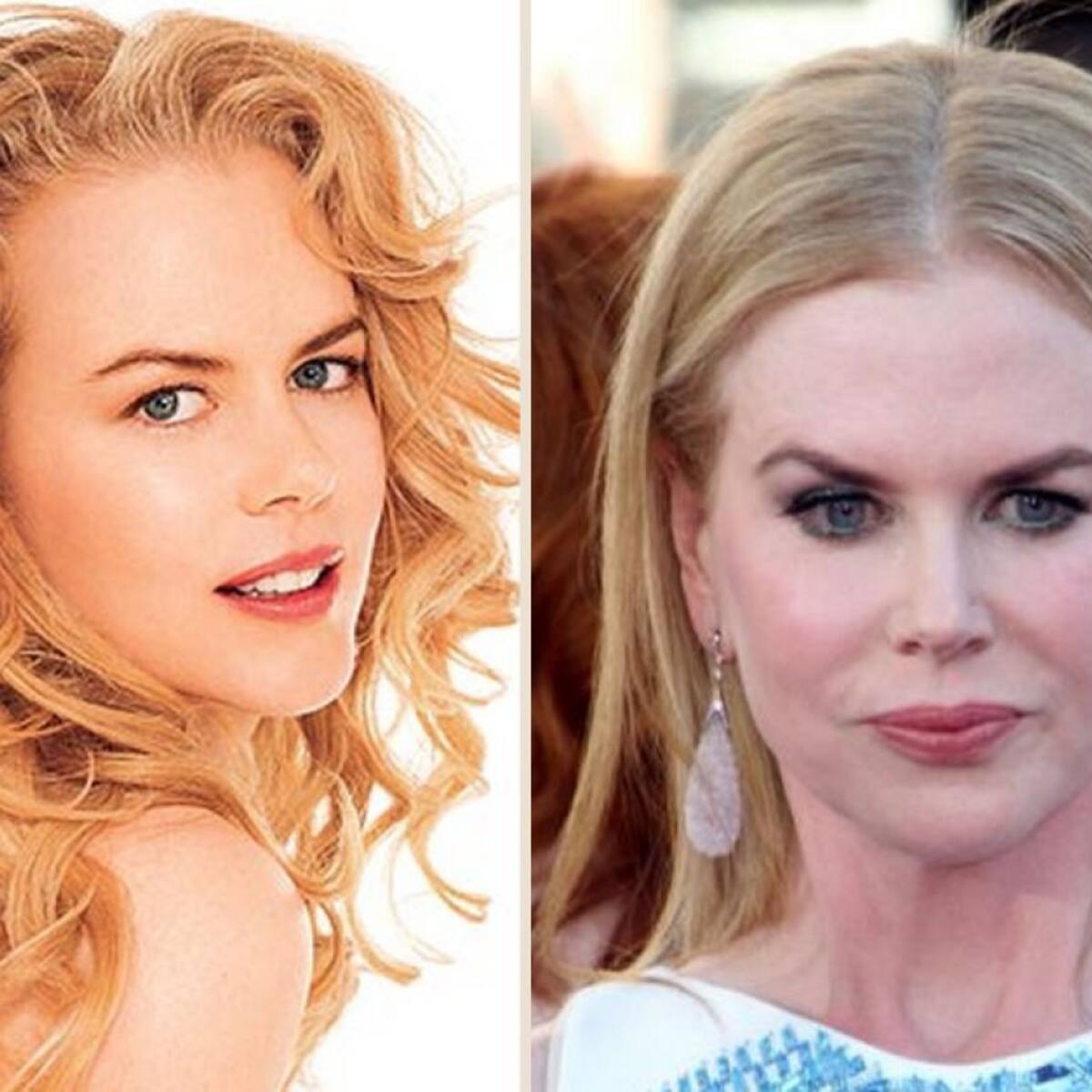 A estas celebrities la cirugía estética no les sentó bien