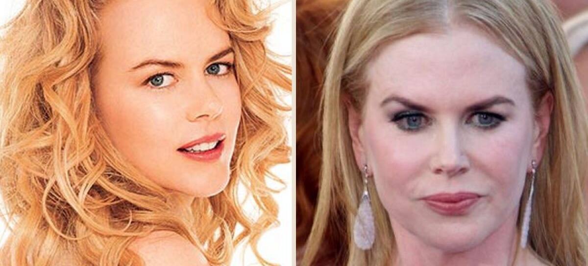 Nicole Kidman